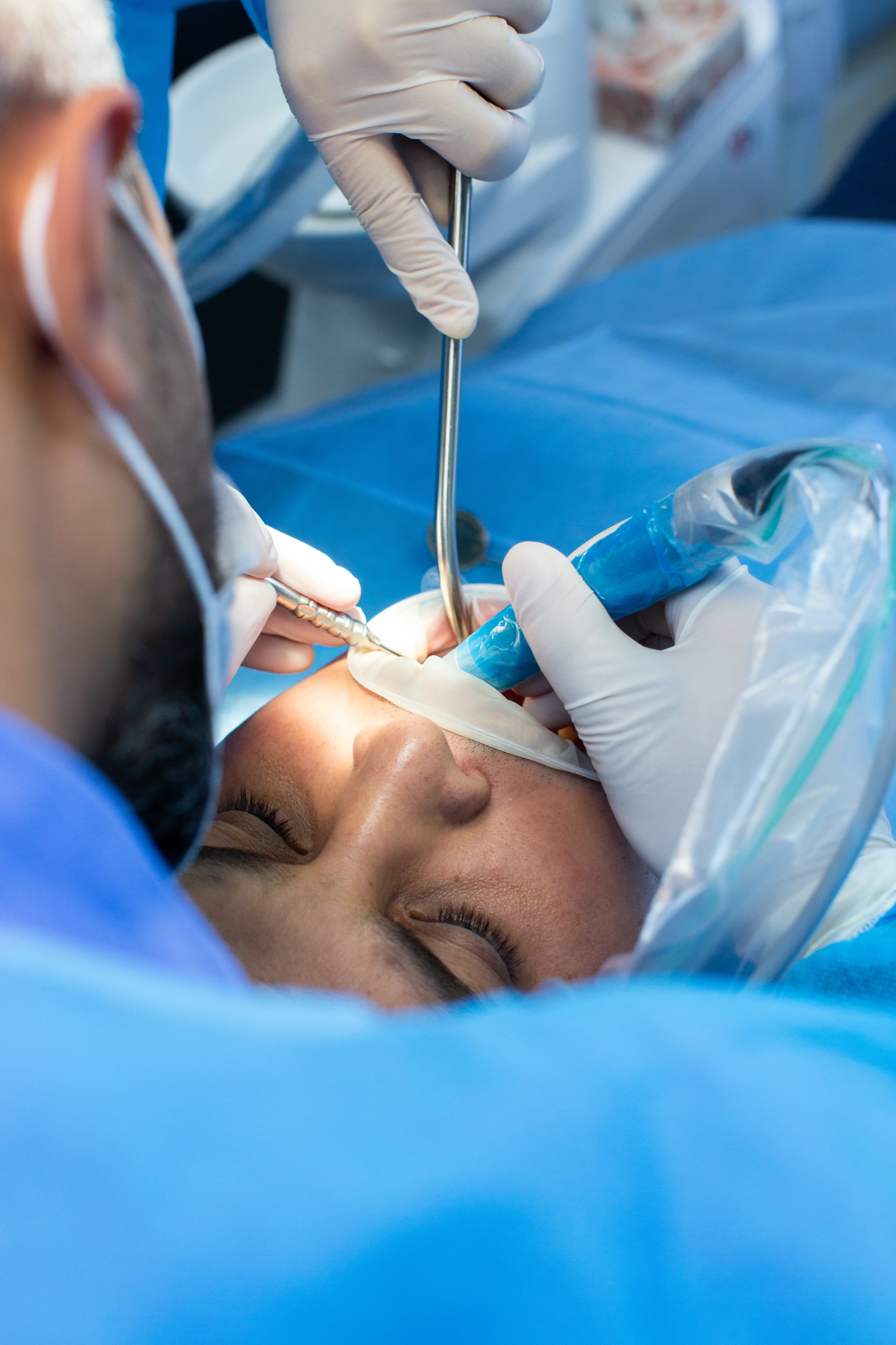 What Is an Apicectomy?