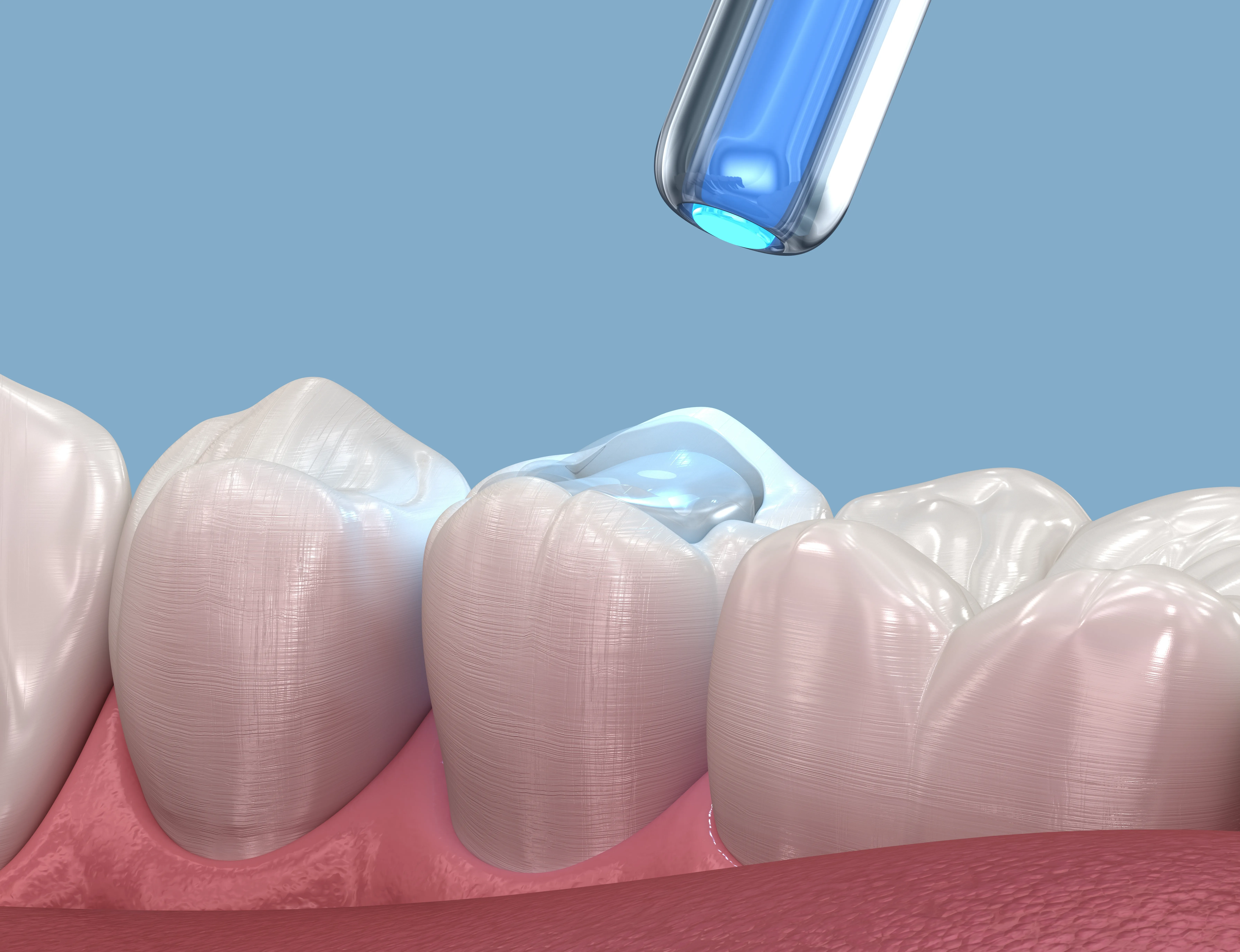 Restorative Dentistry