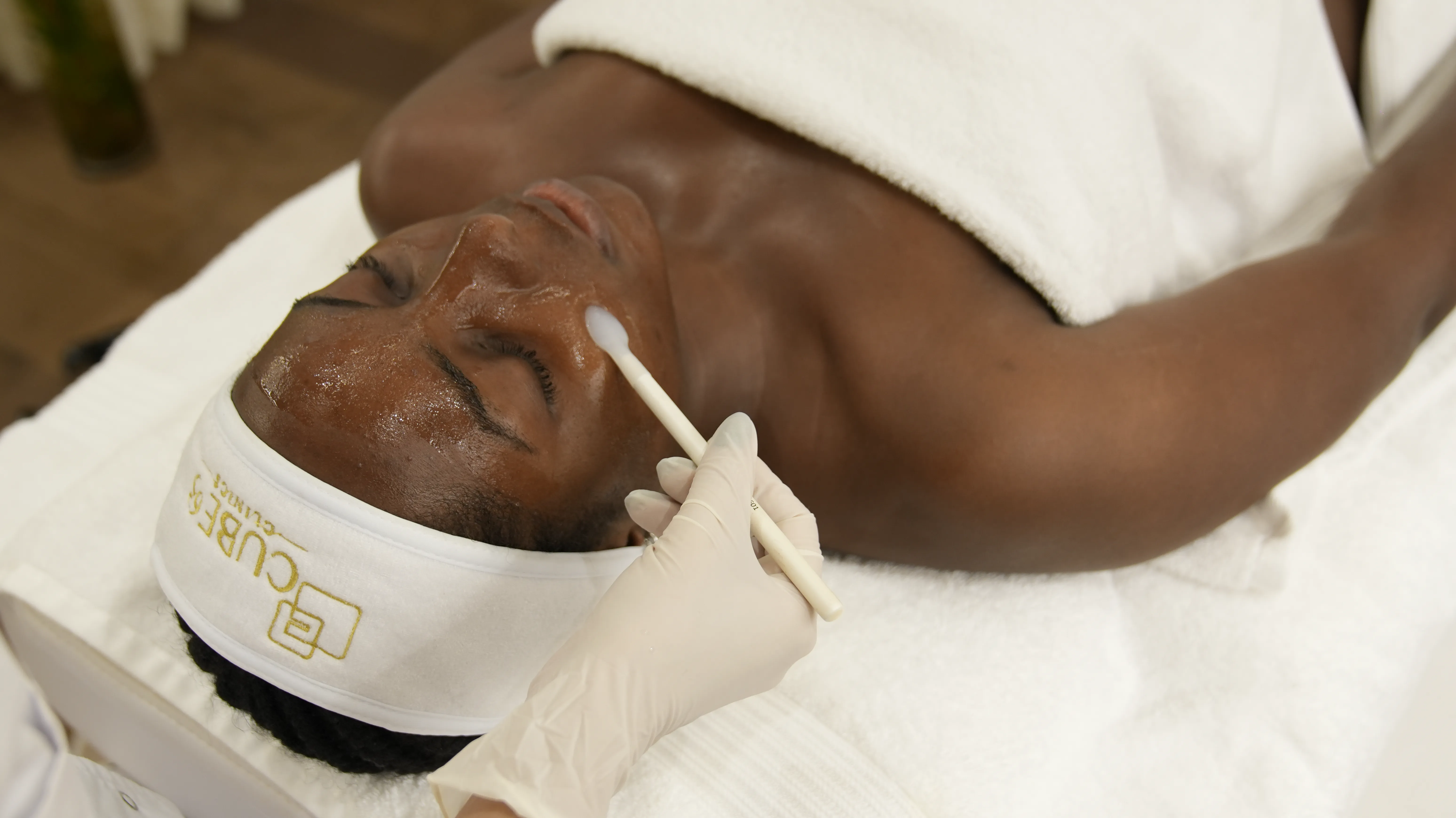 What Is Body Peel?
